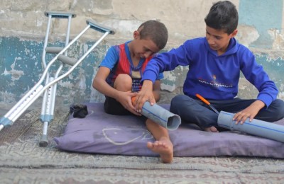 bambini palestinesi amputati